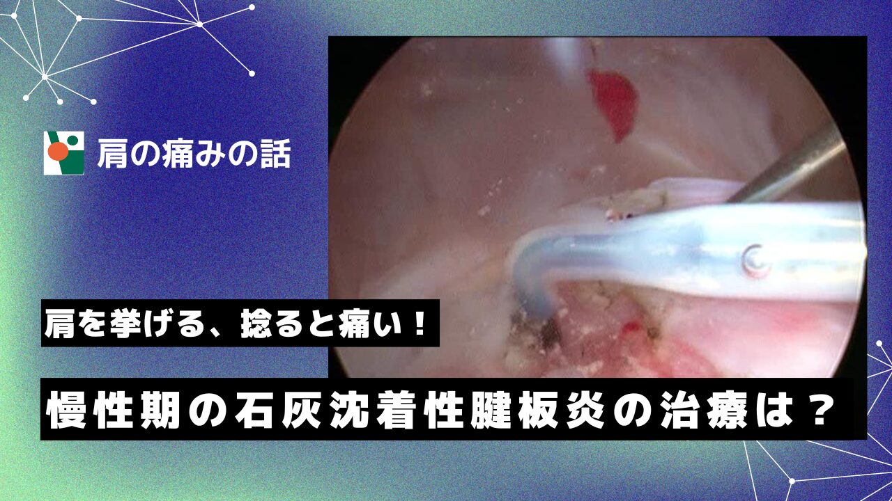 慢性期の石灰沈着性腱板炎の治療は？